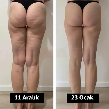 <strong>— Elif K. | İzmir</strong>