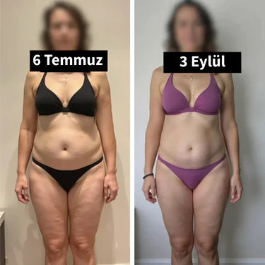 <strong>— Zeynep A. | İstanbul</strong>